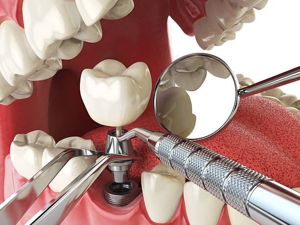 Best Walk-In Emergency Dental Services in Country Homes, WA